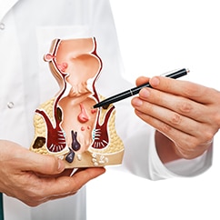 Proctologist pointing pen rectum pathologies on an anatomical model
