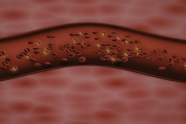 Animated view of the blood stream, suffering from a rare vascular disorder.