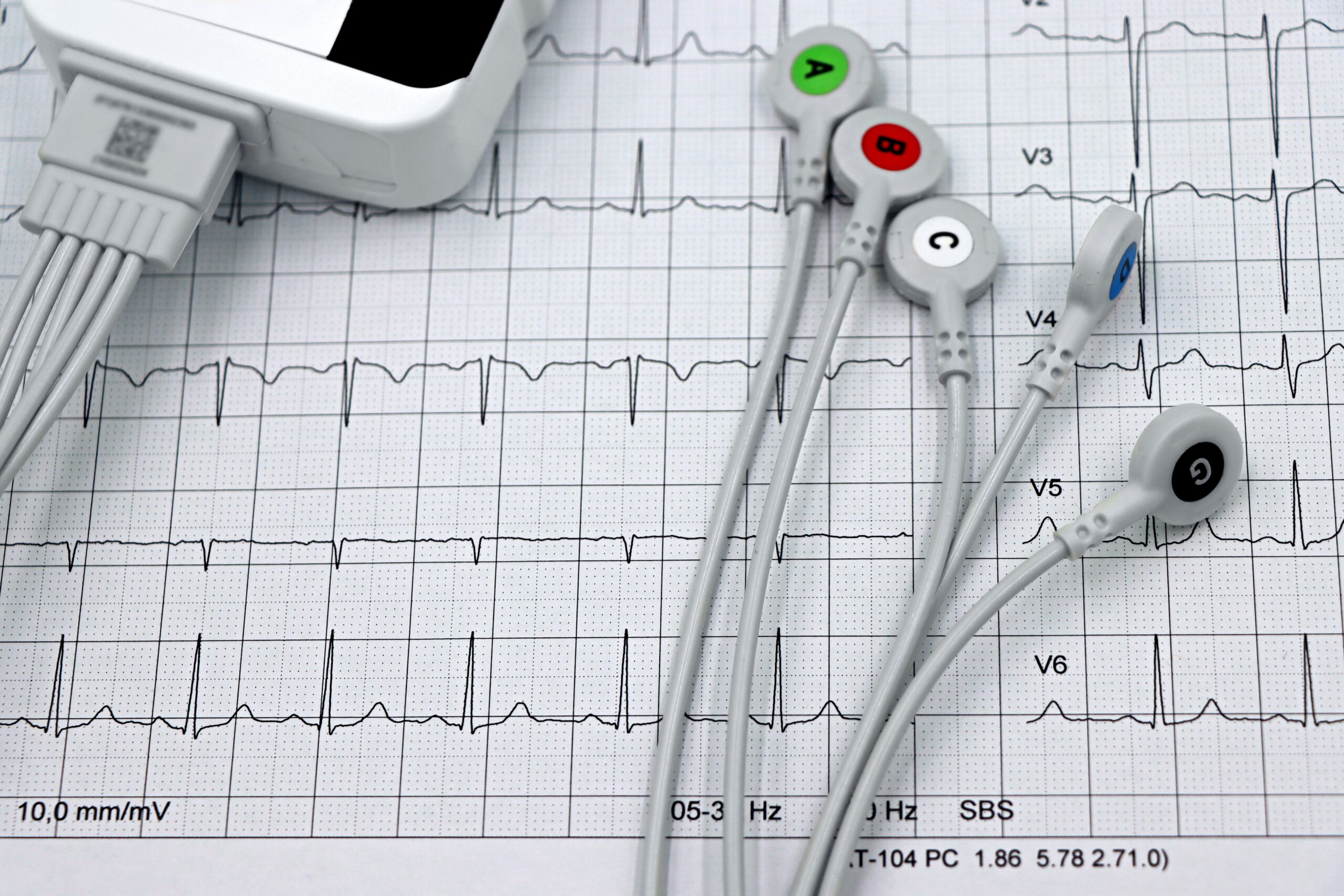 An EKG graph and equipment in a close-up, not in use.